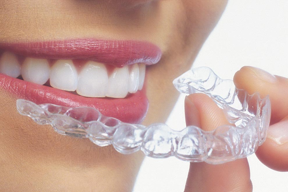 ortodoncia-invisible-invisalign